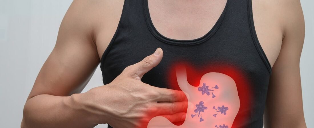 Alimentos con probióticos: Estos son los beneficios para tu digestión Alimentos con probióticos: Estos son los beneficios para tu digestión